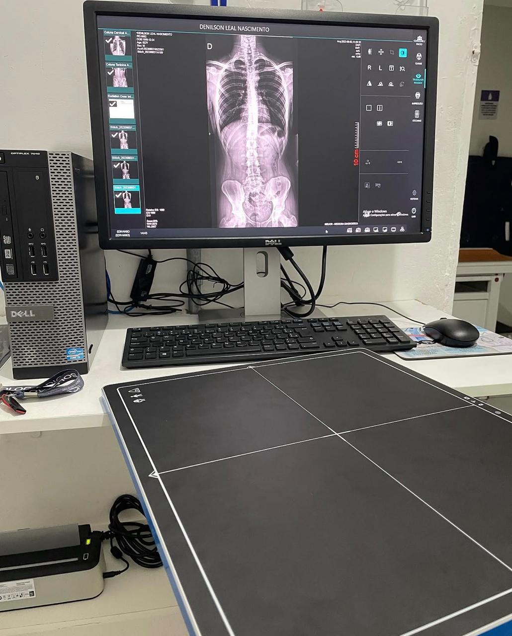 CR (Radiografia Digital)